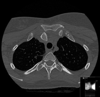 Illustration 77 for Acad Orthop Surg Challenge: Diagnose Shoulder Pain Case 1
