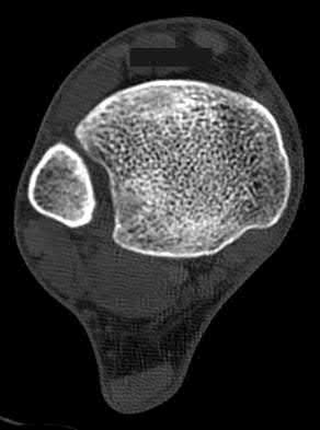 Illustration 65 for OrthoCash: Trauma MCQs & Cases for a yearold woman