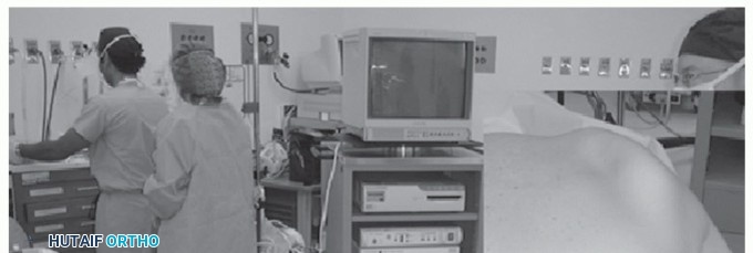 Illustration 11 for Snapping Scapula Syndrome: Why Your Shoulder Clicks & What to Do