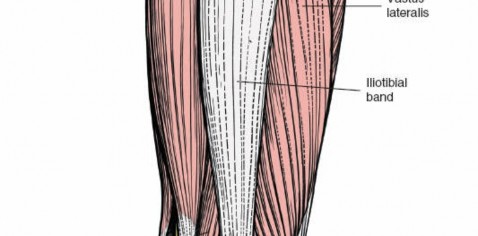 Illustration 89 for Optimal Femoral Approaches: Mastering the Lateral Intermuscular Septum