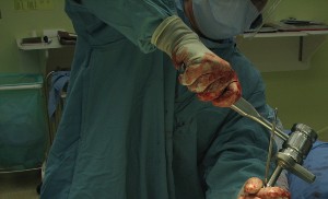 Illustration 56 for Figure Hip Resurfacing: Who Benefits and Who Should Avoid It?