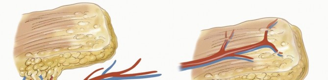 Illustration of posterior interosseous artery - Dr. Mohammed Hutaif