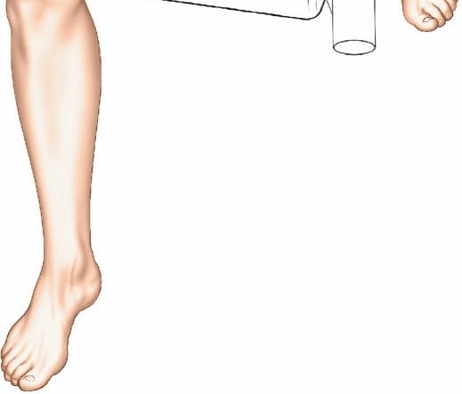 Illustration 121 for Surgical Access: Mastering the Tibia's Surface & Fibula Approaches