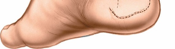 Illustration 48 for Optimized Approaches to the Dorsum of the Foot & Ankle