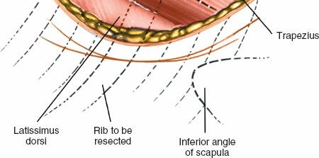 Illustration 293 for Approach to the Lumbar Spine: Mastering Techniques & Anatomy