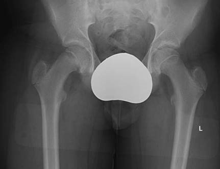 Illustration 17 for Master Hands and Paediatric Orthopaedics: Diagnose & Treat