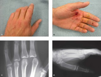 Illustration of joint of the index - Dr. Mohammed Hutaif