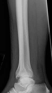 Illustration 143 for OrthoCash: Trauma MCQs & Cases for a yearold woman