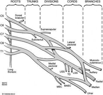 Illustration 4 for Decoding Shoulder Pain: Diagnosing Suprascapular Nerve Entrapment