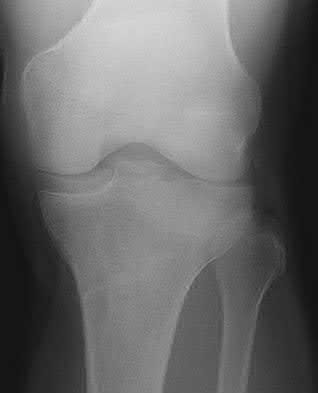 Illustration 38 for OrthoCash: Trauma MCQs & Cases for a yearold woman