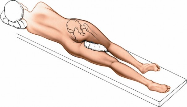 Illustration 168 for Unlocking Every Aspect of the Hip's Surgical Approaches