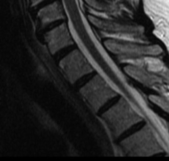 Illustration 30 for Master Orthopedic Spine Cases: Sharpen Your Diagnostic Skills