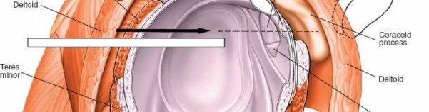 Illustration 220 for Essential Guide: Mastering Every Approach to the Shoulder