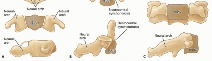 Illustration 2 for Addressing Cervical Spine Instability with Posterior Arthrodesis