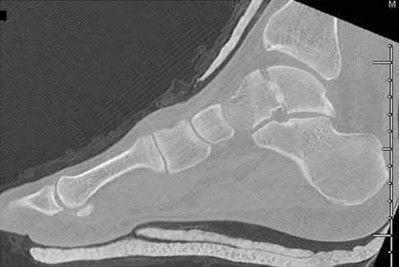 Illustration 157 for OrthoCash: Trauma MCQs & Cases for a yearold woman