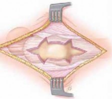 Illustration 18 for J. W. Thomas on Snapping Hip: Causes, Cures & Relief