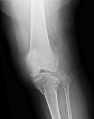 Illustration 151 for OrthoCash: Trauma MCQs & Cases for a yearold woman