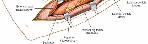 Illustration 67 for Mastering Approaches to the Upper Third of the Radius
