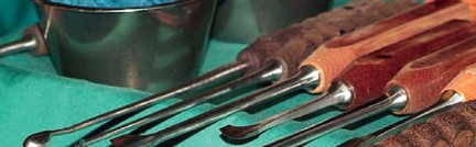 Illustration 25 for Optimizing Infected THA: The One Staged Approach Explained