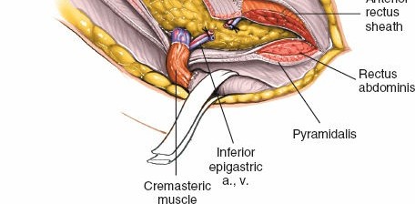Illustration 69 for Pelvis & Acetabulum Approaches: Unlocking the Posterior Superior Iliac