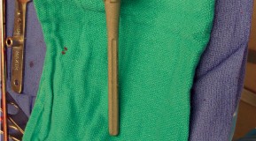 Illustration 47 for Hinged Total Knee: The Salvage Solution for Challenging Cases