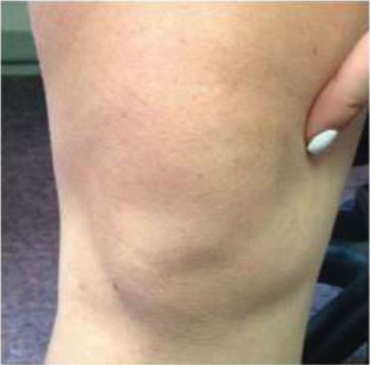 Pediatric Anterior Knee Pain: Solve the Puzzle with Case Insights