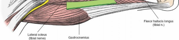 Illustration 74 for Surgical Access: Mastering the Tibia's Surface & Fibula Approaches