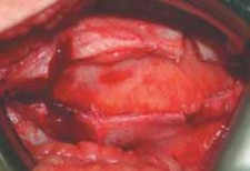 Illustration 19 for J. W. Thomas on Snapping Hip: Causes, Cures & Relief