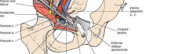 Illustration 101 for Pelvis & Acetabulum Approaches: Unlocking the Posterior Superior Iliac