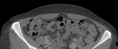 Illustration 189 for OrthoCash: Trauma MCQs & Cases for a yearold woman