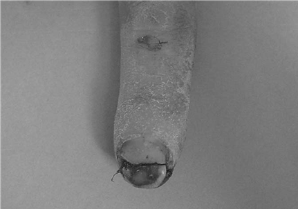 Illustration 13 for Master Hands and Paediatric Orthopaedics: Diagnose & Treat