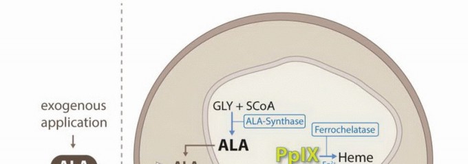 Illustration 2 for Targeted Ablation of Musculoskeletal Tumors: A Safer Approach