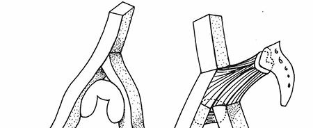 Decoding Acetabulum Fractures & Dislocations: Key Insights