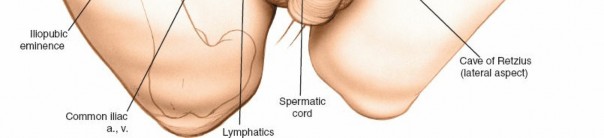 Illustration 29 for Ilioinguinal Approach: Master the Deep Inguinal Ring for Success