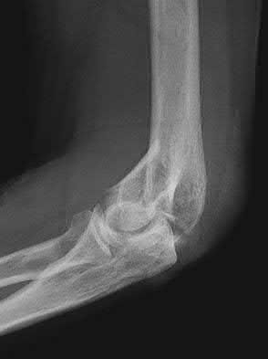 Illustration 73 for OrthoCash: Trauma MCQs & Cases for a yearold woman