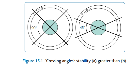 Illustration 1 for Limb Reconstruction: Restoring Function for Challenges Near and Far