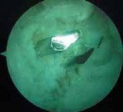 Illustration 16 for Cruciate Ligament Repair: Definitive Guide to Treatment & Recovery