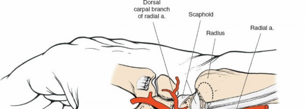 Illustration 200 for Essential Surgical Approaches: Uncover Every Aspect of the Wrist