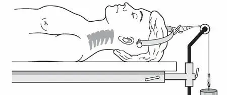 صورة توضيحية لـ دليلك الشامل لعلاج آلام الرقبة وإصابات العمود الفقري العنقي: رحلة نحو الشفاء مع الأستاذ الدكتور محمد هطيف