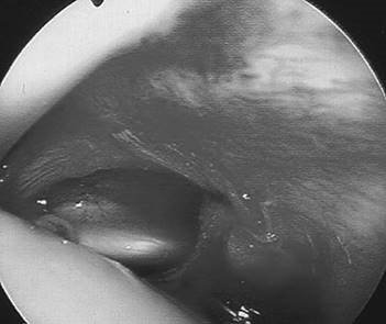 Illustration 25 for Ace FRCS Orthopaedics: Oxford University Press Adult Pathology Viva