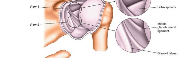 Illustration 237 for Essential Guide: Mastering Every Approach to the Shoulder