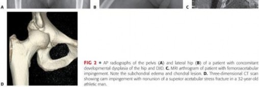 Illustration 77 for Understanding Hip Arthroscopy: The Basics Explained
