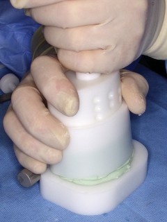 Illustration 27 for PROSTALAC Articulating Spacer: Treat Infected Knees, Regain Mobility