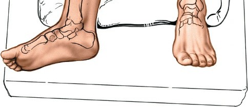 Illustration 3 for Optimized Approaches to the Dorsum of the Foot & Ankle
