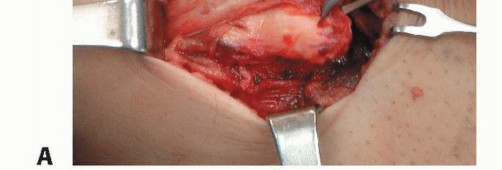 Illustration 17 for Repair & Recover from Collateral Ligament Injuries: Your Guide