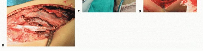 Illustration 12 for Repair & Recover from Collateral Ligament Injuries: Your Guide