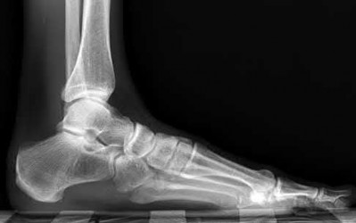 Illustration 103 for OrthoCash: Trauma MCQs & Cases for a yearold woman
