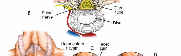 Illustration 31 for Approach to the Lumbar Spine: Mastering Techniques & Anatomy