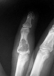 وصف طبي دقيق ومبسط للمريض