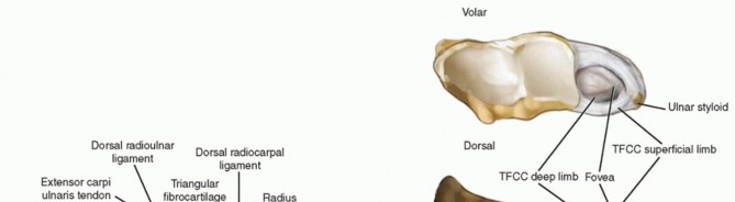 Ulnar Shortening Osteotomy